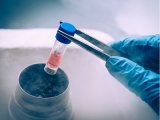 Stem-cell therapy transforms the future of plastic surgery